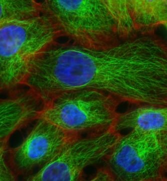 Imagen microscópica de células humanas con tinción fluorescente, fotografía científica ilustrativa para el artículo sobre Biohub y la célula virtual. Archivo del National Cancer Institute, Unsplash; no representa resultados del proyecto Biohub.